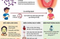 NHỮNG ĐIỀU CẦN BIẾT VỀ BỆNH BẠCH HẦU